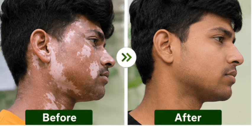 Patient before and after result