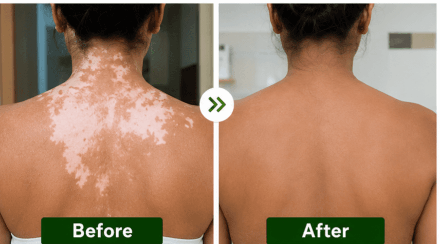 Patient before and after result