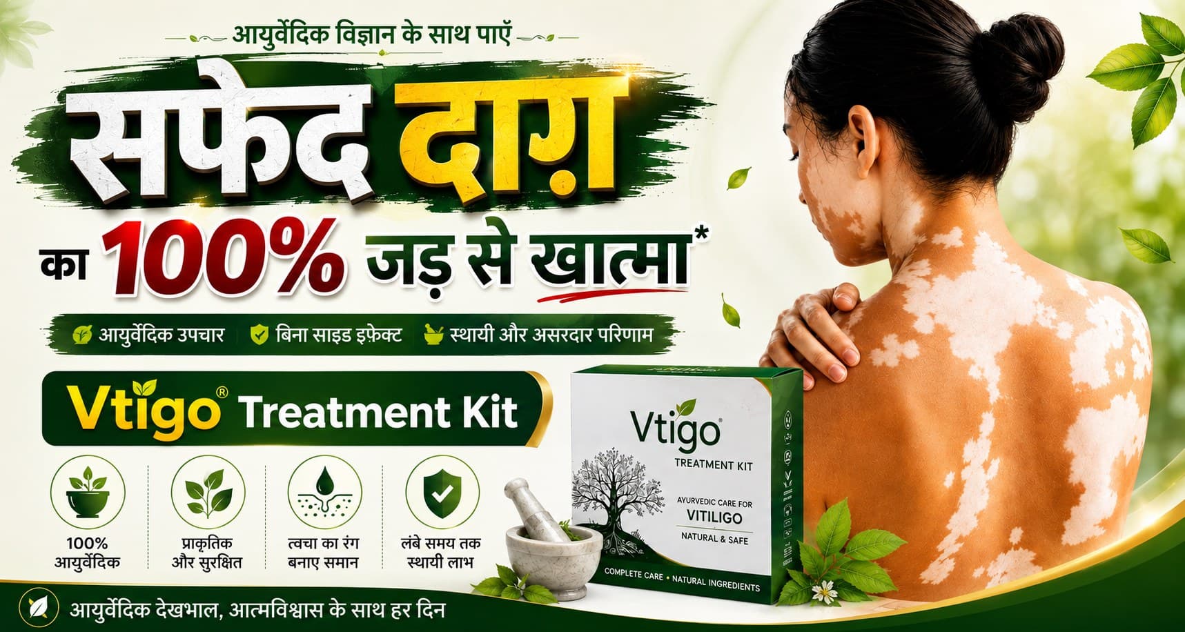 सफेद दाग का 100% जड़ से खात्मा — Vtigo Treatment Kit, आयुर्वेदिक उपचार, बिना साइड इफ़ेक्ट, स्थायी और असरदार परिणाम